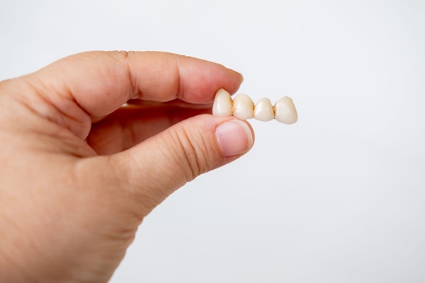 How Often To Replace A Dental Bridge And How To Extend Its Lifespan