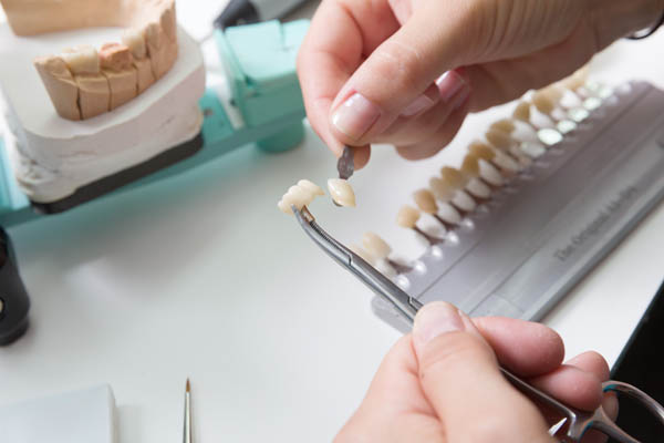 Dental Veneers &#    ; A Teeth Straightening Solution Without Braces
