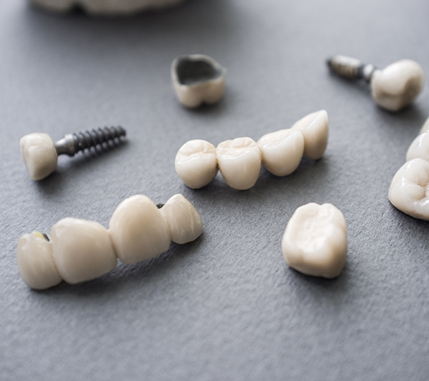 Brentwood The Difference Between Dental Implants and Mini Dental Implants