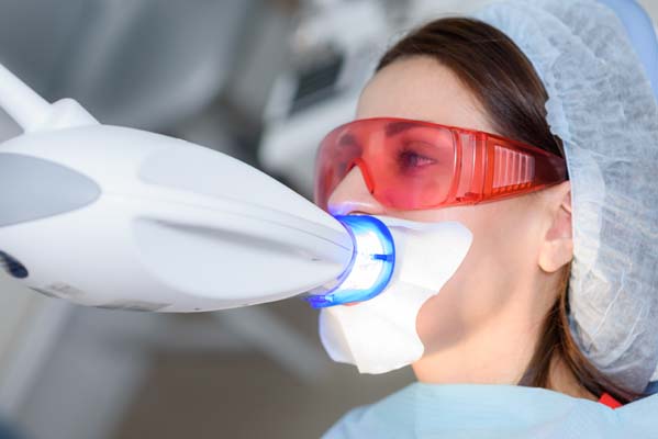 Does Professional Teeth Whitening Produce Permanent Results?